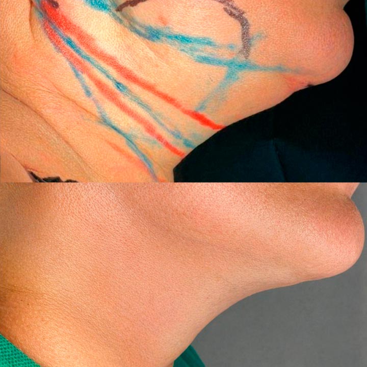 ejemplo-3a
